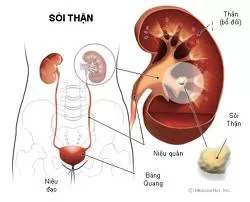 Top 5 Tác dụng thần thánh của Cây chó đẻ