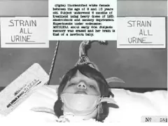 Top 7 thí nghiệm khoa học rùng rợn, đáng sợ nhất thế giới