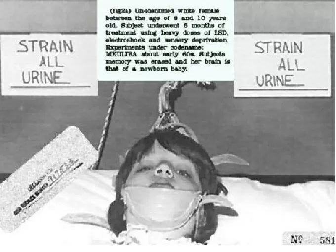 Top 7 thí nghiệm khoa học rùng rợn, đáng sợ nhất thế giới