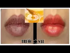Top 5 phương pháp trị thâm môi hiệu quả mà bạn nên biết