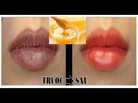 Top 5 phương pháp trị thâm môi hiệu quả mà bạn nên biết