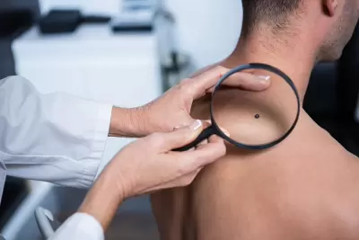 TOP 8 dấu hiệu đầu của ung thư nam giới thường bỏ qua