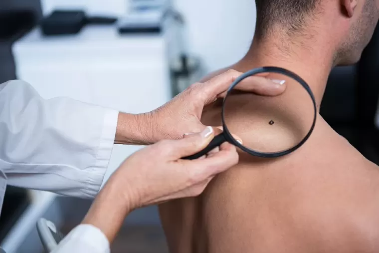 TOP 8 dấu hiệu đầu của ung thư nam giới thường bỏ qua