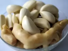 TOP 5 cách chữa sâu răng đơn giản hiệu quả nhất