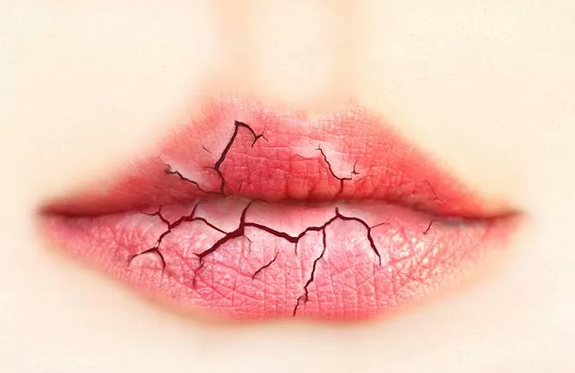 TOP 10 dấu hiệu nhận biết cơ thể đang thiếu nước trầm trọng