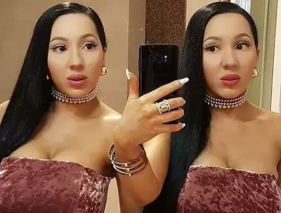 Top 5 ca phẫu thuật thẩm mỹ có nguyên nhân lạ kì nhất