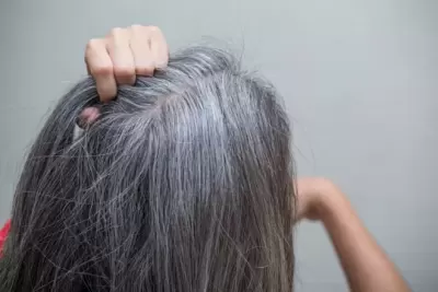 Top 7 chứng bệnh vô cùng kỳ lạ thế giới vẫn chưa tìm ra cách chữa trị