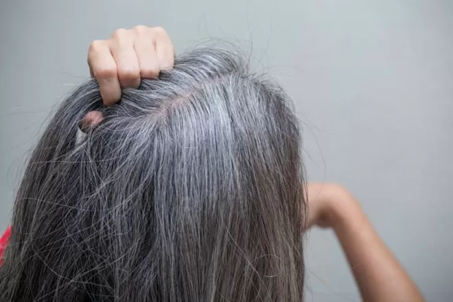 Top 7 chứng bệnh vô cùng kỳ lạ thế giới vẫn chưa tìm ra cách chữa trị